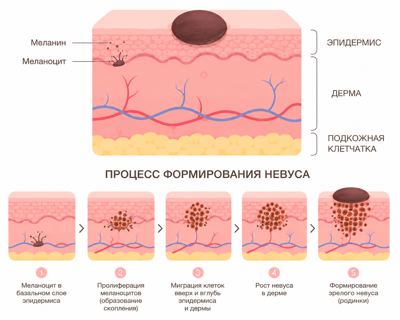 Схема слоев кожи и меланоцитов
