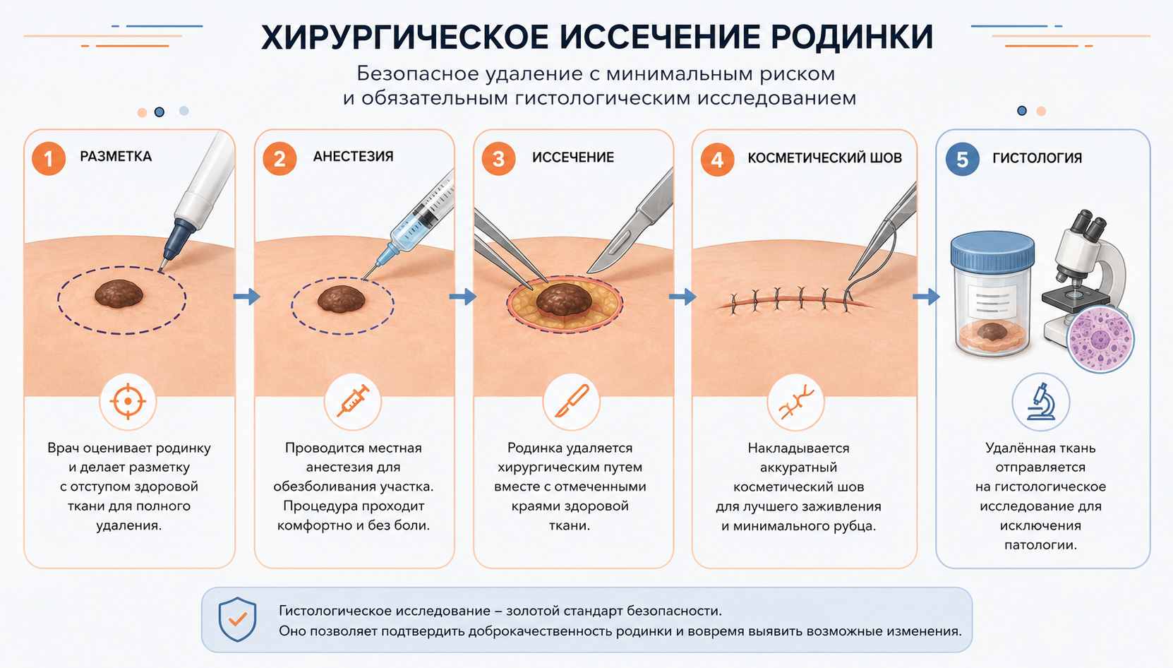 Схема процесса хирургического иссечения